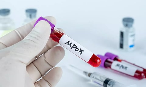 Mpox