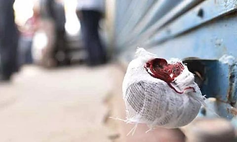 புதுச்சேரியில் மசாஜ் சென்டர்களுக்கு சீல்