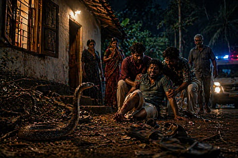 Snake Bite - Representative Image