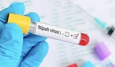 Nipha Virus