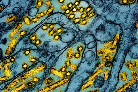 ഓസ്ട്രേലിയയിൽ H5N1 പക്ഷിപ്പനി സ്ഥിരീകരിച്ചു
