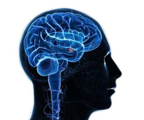 MND ചികിത്സയിൽ വിപ്ലവം: രോഗനിയന്ത്രണത്തിന് പുതിയ മരുന്ന്