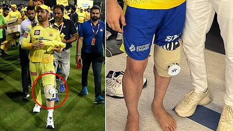 കാൽ മുട്ടിന് പരുക്ക്; ചികിത്സതേടി ധോണി