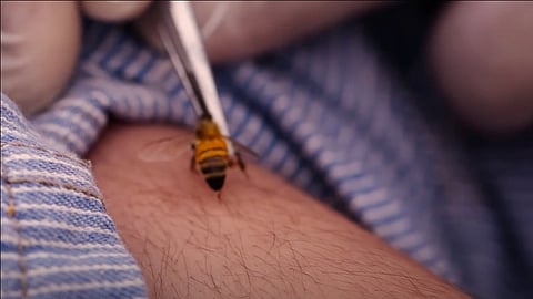 compensation in case of loss of life due to bee and wasp attacks