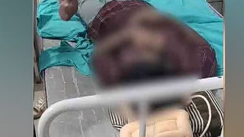 മർദനമേറ്റ് ആശുപത്രിയിൽ കഴിയുന്ന കുട്ടി