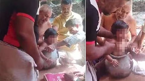 കുട്ടി അലുമിനിയം പാത്രത്തിൽ കുടുങ്ങിയതിന്റെ ദൃശ്യങ്ങൾ