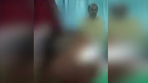 തെരുവ് നായയുടെ കടിയേറ്റ് മൂന്നര വയസുകാരന് ഗുരുതരപരിക്ക്