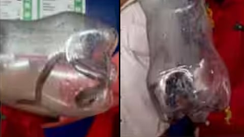 woman was bitten by a snake in a government hospital palakkad