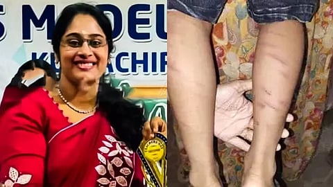 Teacher arrested for brutally beating 5-year-old boy Thrissur