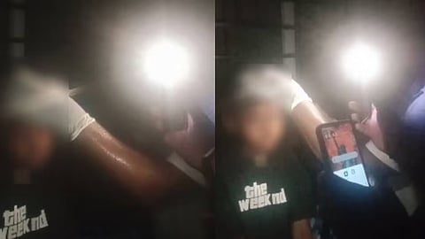 the child was taken to the hospital with a head injury; Stitched in the light of the phone