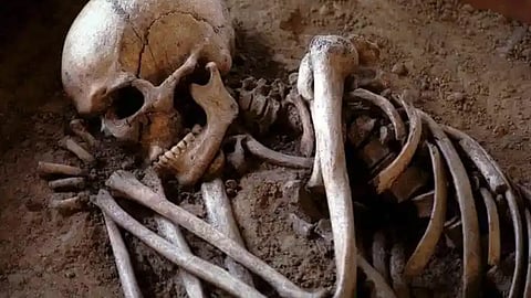 Nokia Phone Help to Identify Skeleton Hyderabad