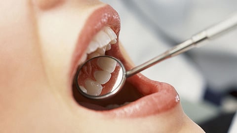 loosing teeth oral health