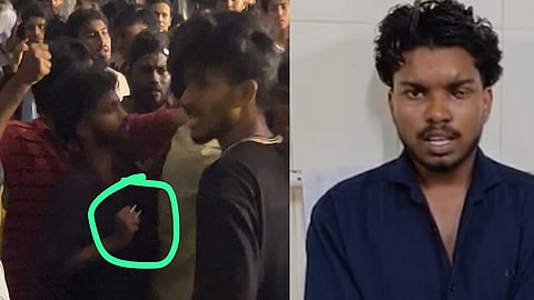 engineering Student Loses Vision on Drunk gang attack