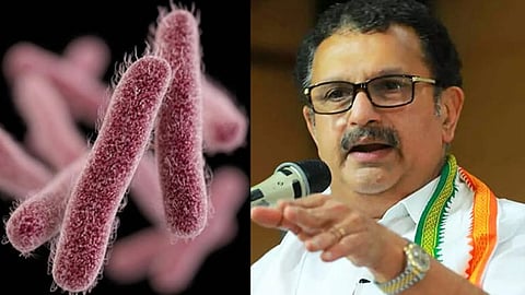 126 shigella cases in kerala