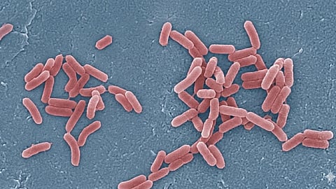 shigella reported again in kozhikode
