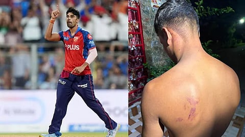 case filed against ipl player shashank singh and his father for beating and abusing cook