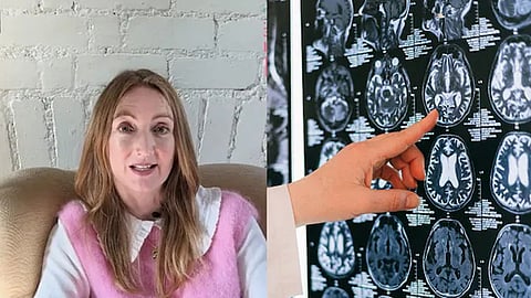 pork after arriving in India; 38 parasites found in foreigner's brain