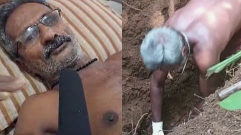Contracted infection from a maggot-infested corpse