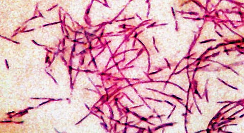 Legionnaires' disease: Three deaths, 74 infected in New York