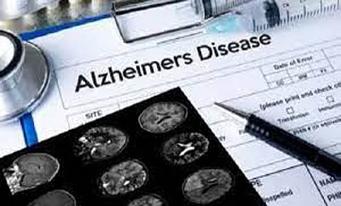Naturally existing genetic resilience found in patient predisposed to Alzheimer's