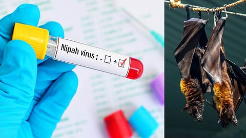 Nipah virus