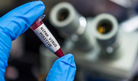 Kerala gets antibody to fight Nipah virus; mobile lab to test samples