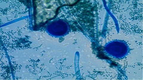 Fungal infection