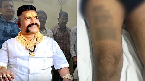 Spa murder victim tattooed names of his enemies on body; arrested suspect one of them