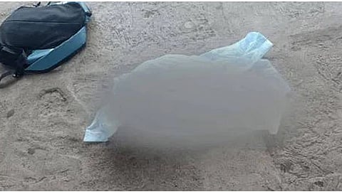 Body of two-day-old infant