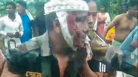 An injured Assam Rifles officer is escorted after a suspected improvised explosive device (IED) blast near Sukhovi in Chumoukedima district, Nagaland, Monday, July 13, 2026.