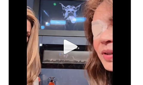 Yolanda Andrade reaparece con parche luego de problema en la cabeza