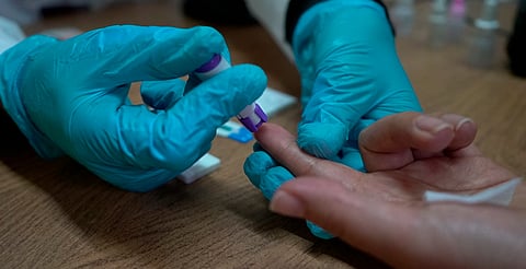 Realiza SSM detección oportuna de hepatitis C
