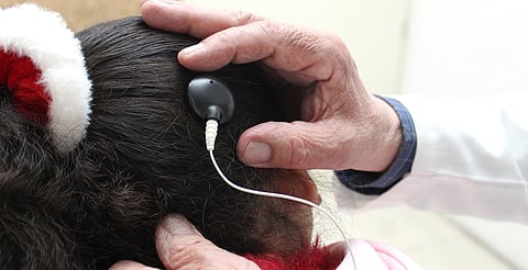 Modificaciones en procesos administrativos y médicos aprobados por el Consejo Técnico del Seguro Social en 2024, permitieron realizar la primera jornada quirúrgica institucional de implante cocleares, en beneficio de 15 niñas y niños