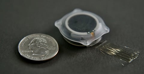 ¿Adiós al celular? Elon Musk propone chips cerebrales para navegar y enviar mensajes con la mente