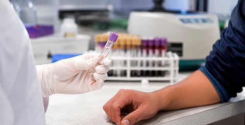 Sin denuncia y de forma confidencial: harán toma de ADN en Maravatío