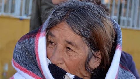 Se recomienda utilizar protector solar en cara, manos y orejas, así como baños tibios (Foto: Secretaría de Salud)