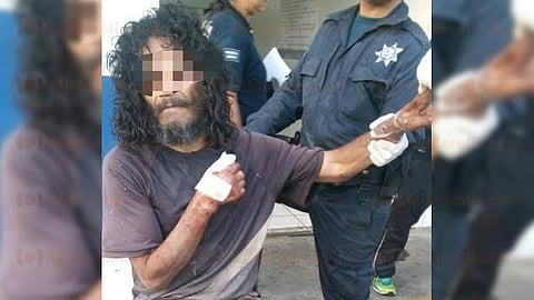 El estado de salud del agredido es reportado como delicado