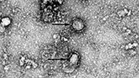 Hasta el momento, ningún médico ha podido encontrar un tratamiento para controlar el virus (Foto: Instituto de Microbiología, de la Academia de Ciencias de China)