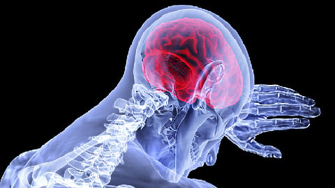 El 36% de un grupo de 214 pacientes chinos observados por médicos, tuvieron síntomas neurológicos como neuralgias (Foro: pixabay.com)