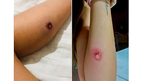 La joven dijo que hace público el caso para que no se repitan casos como éste y las personas estén alerta (Foto: Captura de pantalla)
