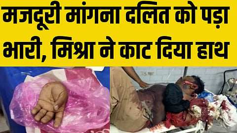 गणेश मिश्रा ने दलित का मज़दूर का हाथ काट दिया।