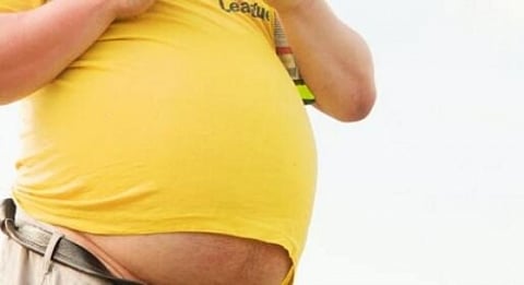 Obesity