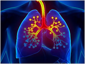 Asthma