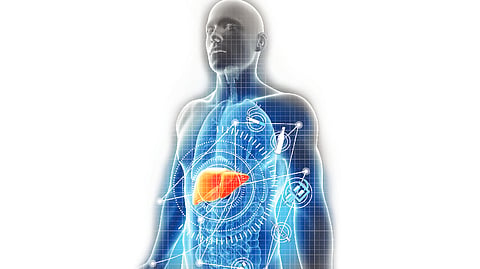 Representational image
