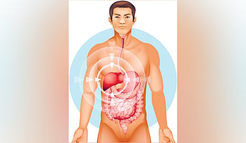 Representational image