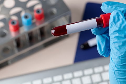 India, often termed the thalassemia capital, has 1–1.5 lakh patients, with 20–40% relying on desferoxamine (Desferal) by Novartis.