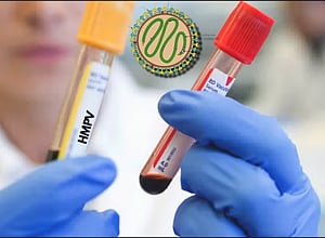 HMPV, which has been present globally since 2001, is one of the many respiratory viruses that can cause infections in people of all ages particularly during the winter and early spring months.