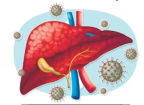 To prevent hepatitis A, we basically need to ensure the water sources are safe, said Dr Rajeev Jayadevan, convenor of the Indian Medical Association’s research cell.