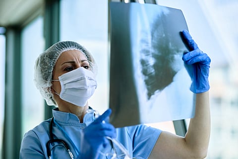 Image used for representative purpose.