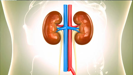 CAPD fluid is a sterile solution containing dextrose that is used in the dialysis procedure to remove waste and excess fluid from the body when kidneys fail.